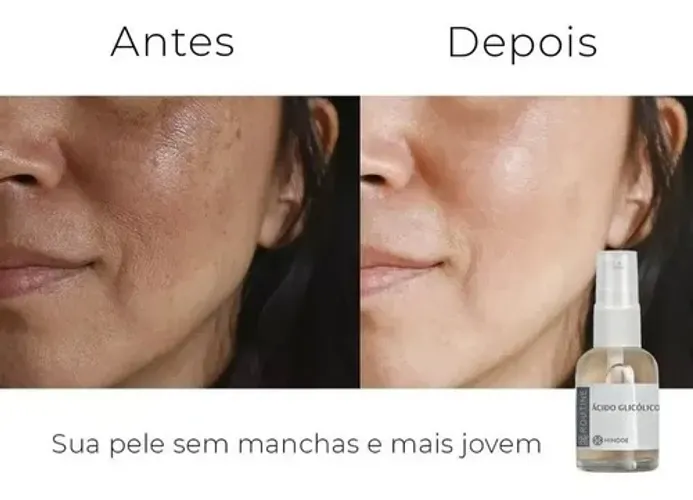Tira Mancha - Acido Glicolico