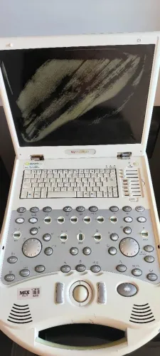 Ultrassom Portátil My Lab 30 Gold Transdutor Linear