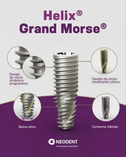 Implantes Neodent Grand Morse (GM) Originais e Lacrados