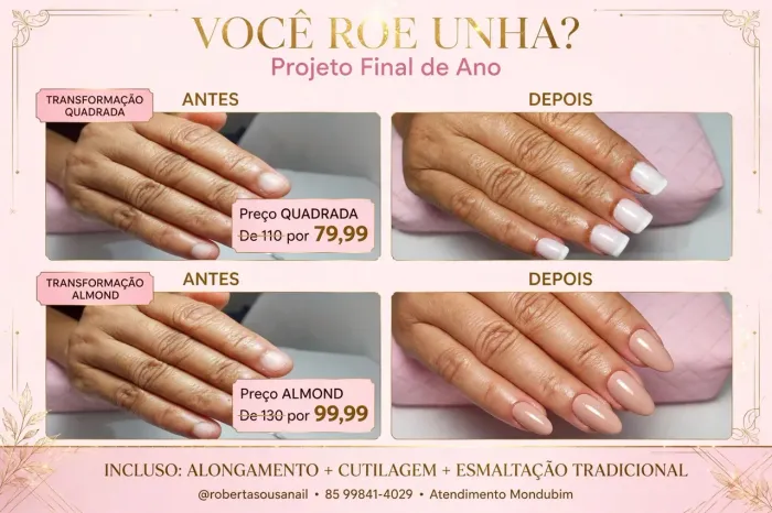 Você tem unhas roidas?