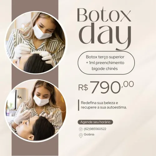Preenchimento de bigode chinês e botox