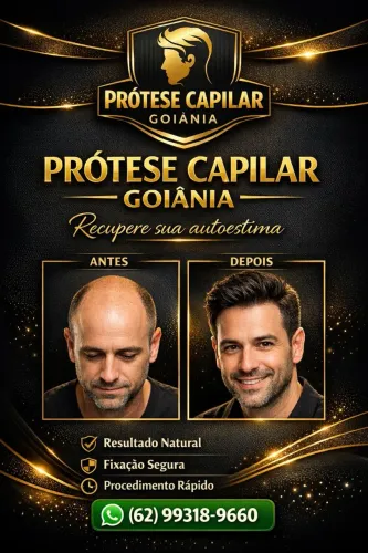Prótese capilar 