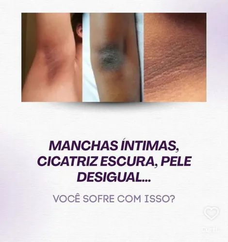Clareamento intimo
