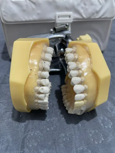 Prótese odontológica 