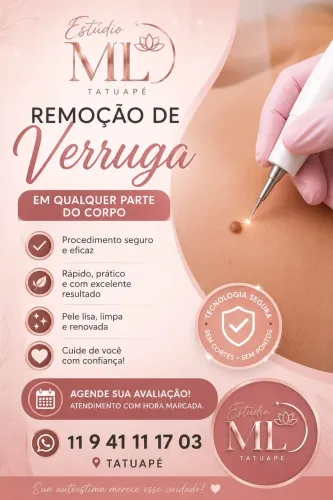 Remoção de verruga