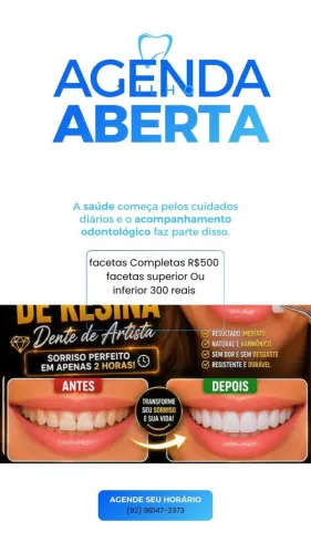 Promoção de facetas