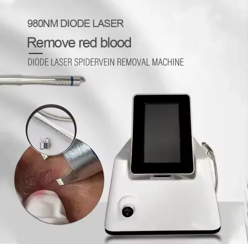 Máquina laser remoção de micro vasos