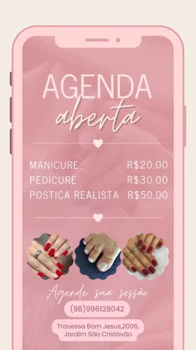 Unhas
