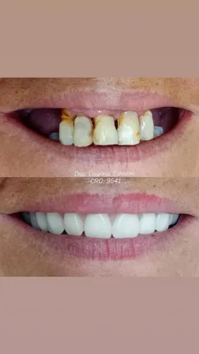 PRÓTESE DENTÁRIA