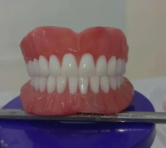 #Proteses Dental em Fortaleza