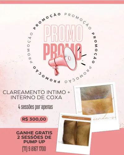 Clareamento de manchas - promoção 
