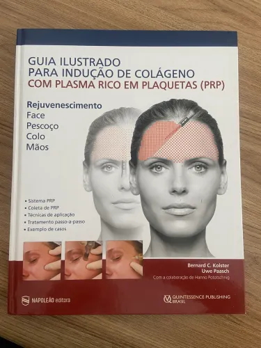 Guia Ilustrado Para Indução De Colágeno Com Plasma Rico Em Plaquetas