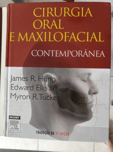 Cirurgia Oral e Maxilofacial 5.ª edição - PETERSON