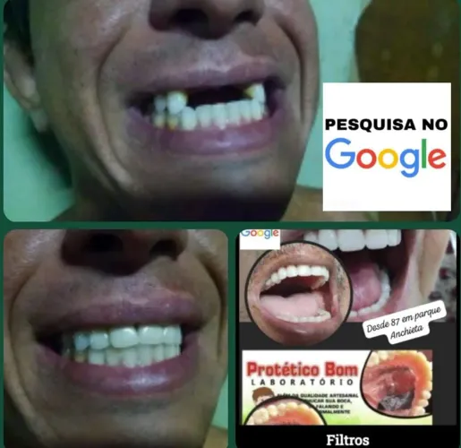 PROTETICOBOM®?
