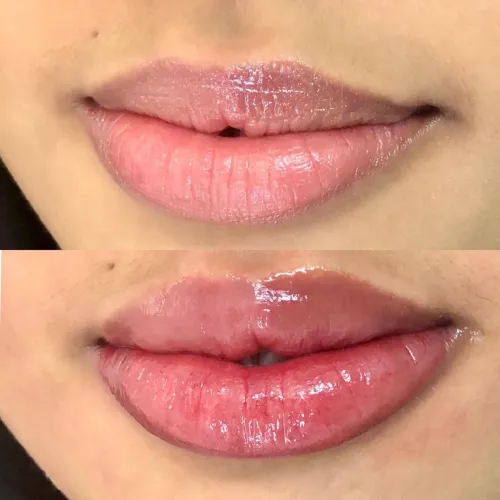 MODELO PARA MICROPIGMENTAÇÃO LABIAL - VALOR ESPECIAL