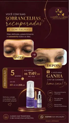 Tenha sua sobrancelha natural de volta
