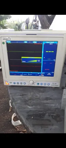 Monitor multiparametro