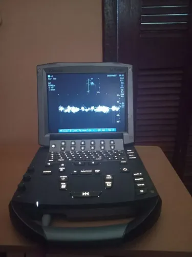 Ecocardiograma sonosite portátil setorial