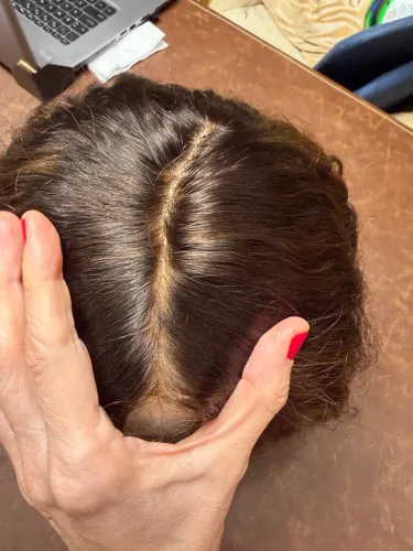 Cabelo humano