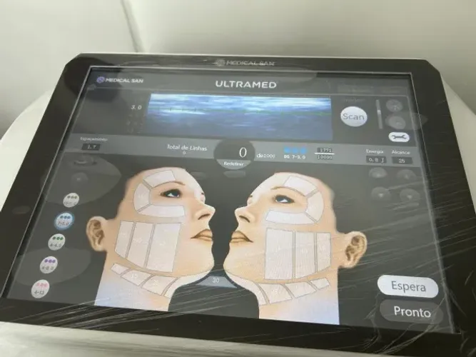 Ultrassom Microfocado Ultramed - Tecnologia Avançada no Rejuvenescimento