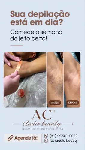 DEPILAÇÃO