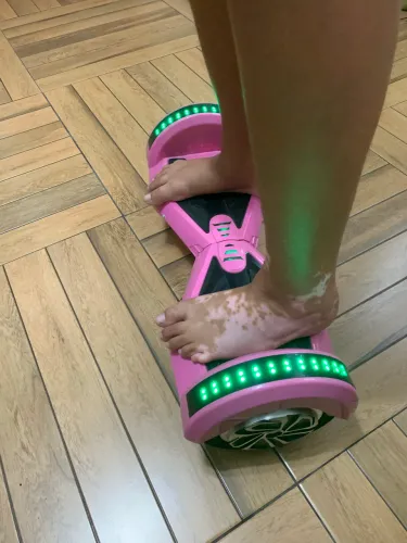 Hoverboard rosa com led
