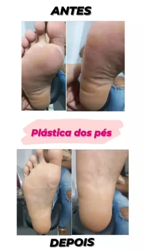Spa dos pés 