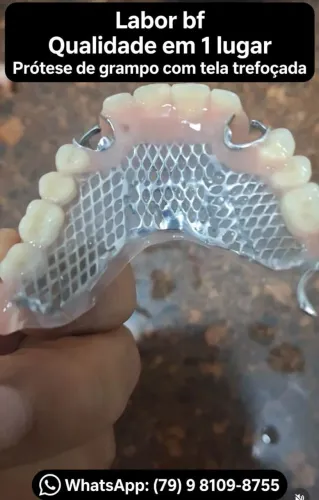 Laboratório de protese dentaria