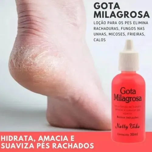 Gota Milagrosa Natty Vida 10 unidades hidratante anti rachadura pés mãos cotovelos
