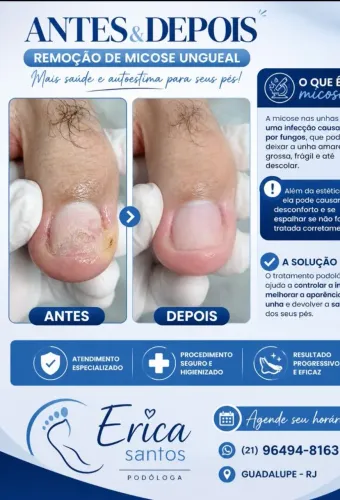 Podologia adomicilio 