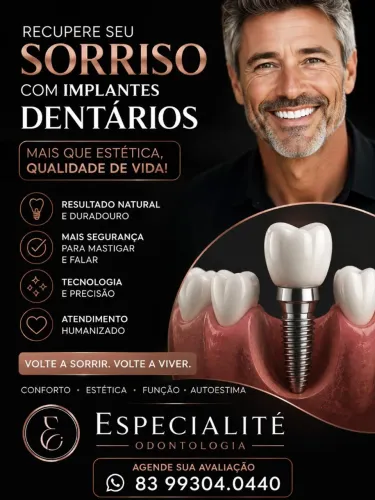 Implantes Dentários em João Pessoa com Atendimento Premium