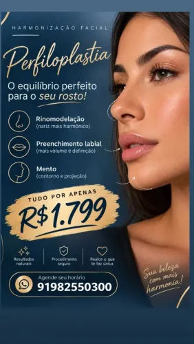 Harmonização facial