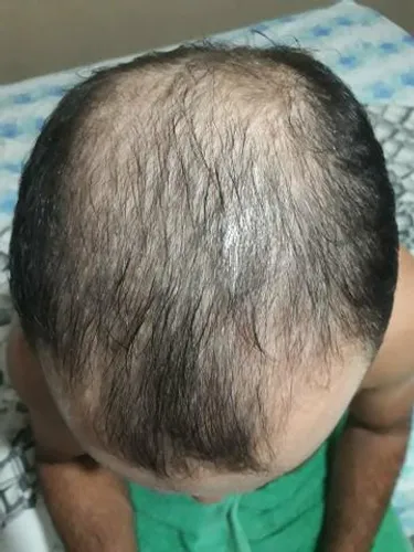 Produto para crescer barba, cabelos e sobrancelhas