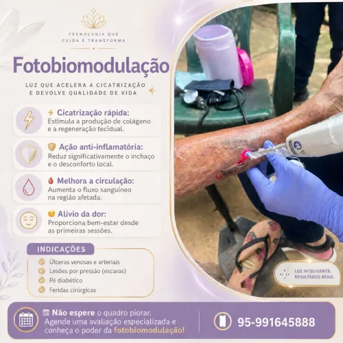 Laserterapia 