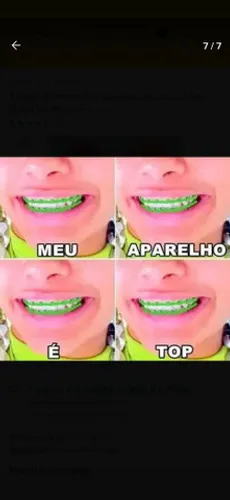 LIGAS, ARCOS E TROCADORES 