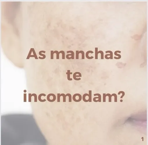 As manchas te incomodam? Rotina facial com a MARY KAY