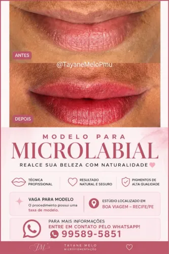 Preciso de Modelos para Micro Labial