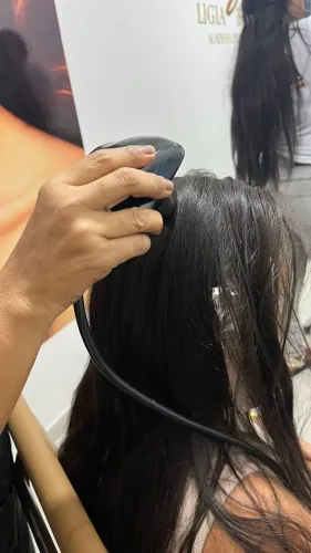 Dermatoscopio análise capilar .