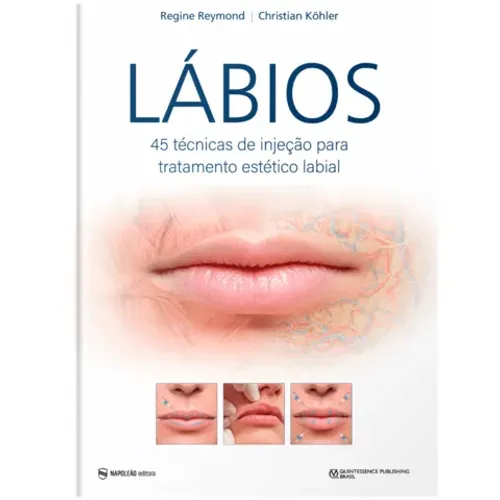 Lábios 45 Técnicas De Injeção Para Tratamento Estético Labial, De Regine Reymond E Christi