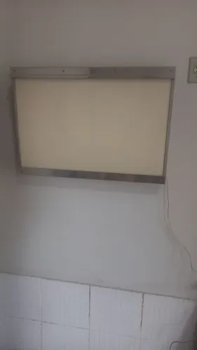 NEGATOSCÓPIO