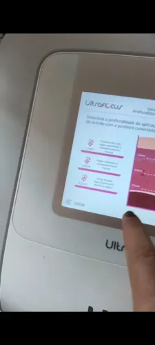 Vendo ultraformer HTM pra vender rápido