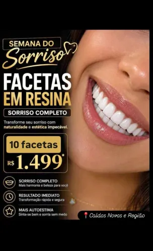 Facetas de resina