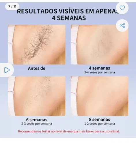 Vende se laser depilação.