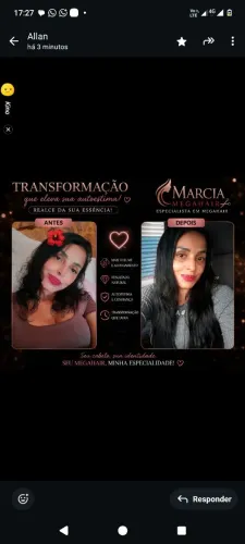 Implantista mega hair todos os métodos barra do Piraí 