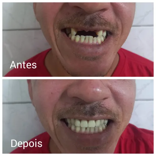 PRÓTESE DENTARIA 