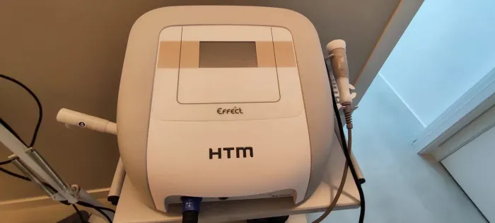 Radiofrequência Effect - HTM