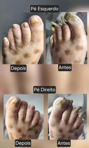 Podologia Popular Preventiva