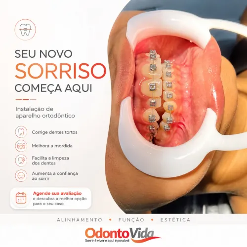 Aparelho ortodôntico 
