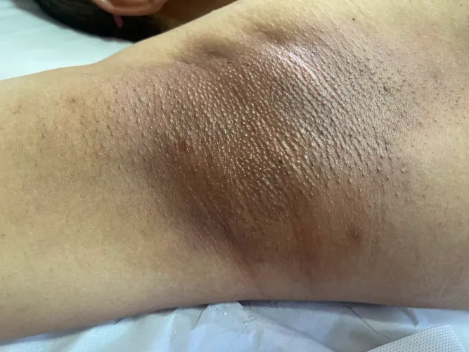 Depilação a domicílio , limpeza de pele sobrancelha margem , público femenino