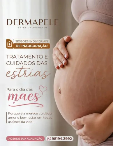 Tratamento Estrias, Cicatrizes 